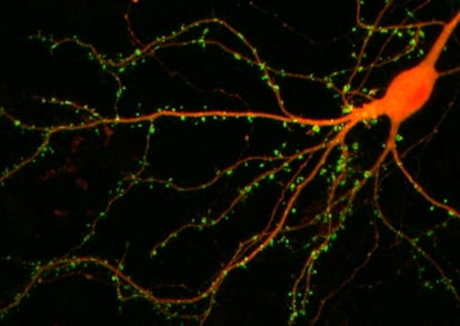 Las células nerviosas (en naranja) se conectan y comunican entre sí en sinapsis (en verde) y emiten compuesto químicos implicados en los procesos de ansiedad.