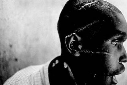 "Los machetes o, como se conocen en gran parte de África, <i>pangas",</i> escribe Jon Lee Anderson, "son uno de
los instrumentos de guerra más comunes". La fotografía, realizada en Ruanda en 1994, muestra las mutilaciones de machete sufridas por un miembro de la etnia hutu.