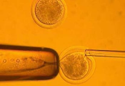 Transferencia nuclear durante el proceso de clonación humana desarrollado por los investigadores coreanos.