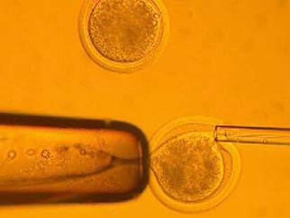 Transferencia nuclear durante el proceso de clonación humana desarrollado por los investigadores coreanos.