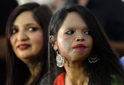 Duas das modelos que participam do desfile organizado por 'Stop Acid Sale' esperam o início do evento, em 7 de março.