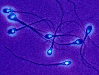 The testicular temperature of mammals is vital for efficient spermatogenesis.