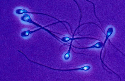 The testicular temperature of mammals is vital for efficient spermatogenesis.