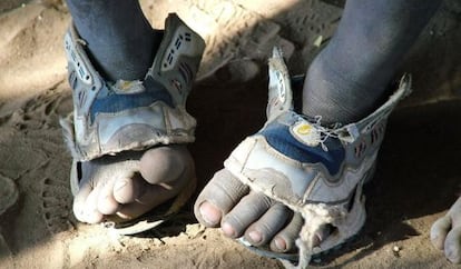 Unos pies de niño con zapatos rotos.