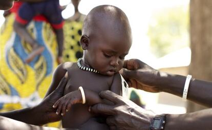 Un niño es atendido por un médico para conocer su estado de desnutrición.