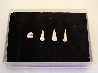 Dientes de una niña neandertal