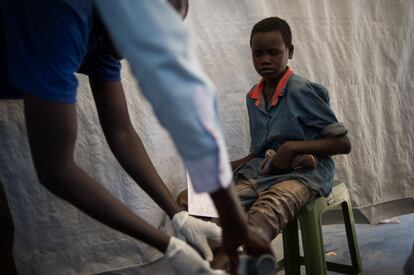 En la clínica de MSF en Juba un chico recibe atención médica para limpiar sus heridas infectadas.