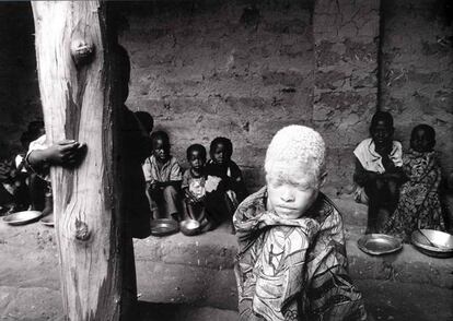 Los niños reciben alimentos del Programa Mundial de Alimentos (PAM), en el centro de acogida de Malange. La niña albina ha sido apartada como una extraña entre su propia gente. Premio tercera edición, 1999 - 2000.