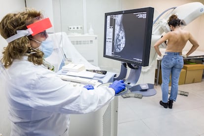 Una mujer se hace una mamografía en un hospital de Catania (Italia), el pasado año.
