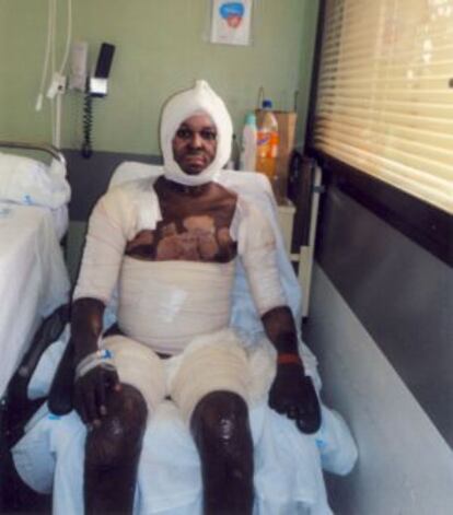 Patrick Hervé, en el hospital de Getafe.