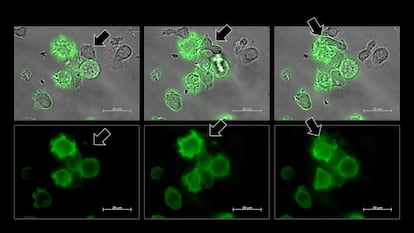 NK Cell