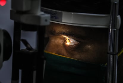 Un hombre se somete a un control ante la sospecha de estar infectado con mucormicosis, en un hospital de Bombay, India.