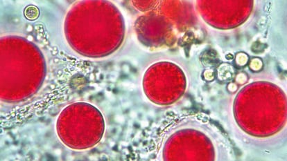 Microalgas de la especie 'Sanguina nivaloides', la llamada sangre de los glaciares, al microscopio.