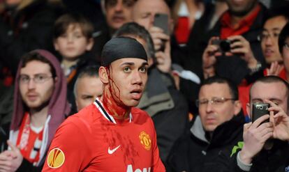 El jugador Chris Smalling, del Manchester United, se retira sangrando del terreno de juego.