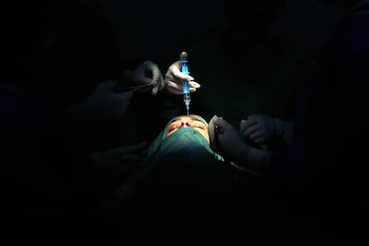 Una mujer se somete a una rinoplastia en Teherán, Irán, el 13 de octubre de 2023.