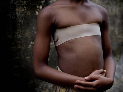 A tortura silenciosa para que as meninas africanas não se tornem mulheres