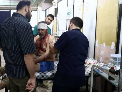 Un herido es tratado en un hospital de campa&ntilde;a en Duma, al este de la capital siria, Damasco.
