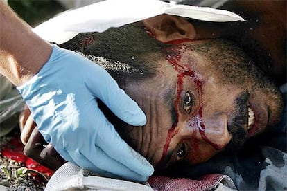 Un médico australiano atiende a un hombre herido con machete durante las refriegas de ayer en Dili.