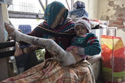 La madre de Krish lo sujeta en los bancos corridos de la entrada al improvisado centro de quemados que ha construido Jawahar Lal al lado de su tienda de dulces. Este niño de seis años se quemó durante una barbacoa.