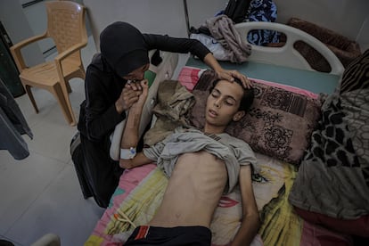 El adolescente palestino de 17 años Atif Aid Abu Khater, que pesa solo 25 kilos por la malnutrición, recibe tratamiento en condiciones límite en el hospital de Al-Shifa, en Ciudad de Gaza, este viernes.
