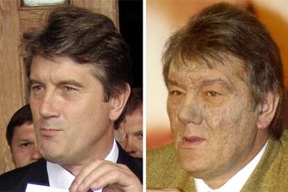 Aspecto de Yúshenko, antes y después del envenenamiento.
