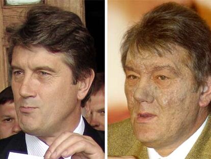 Aspecto de Yúshenko, antes y después del envenenamiento.