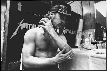 James Hetfield se aplica aloe vera en las quemaduras de su brazo después de que los efectos especiales prendieran fuego durante una actuación de Metallica en Montreal en 1992.
