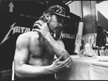 James Hetfield se aplica aloe vera en las quemaduras de su brazo después de que los efectos especiales prendieran fuego durante una actuación de Metallica en Montreal en 1992.
