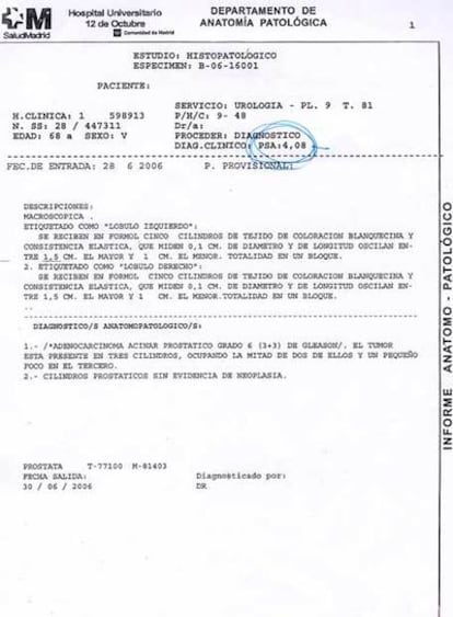 Copia de los resultados de la biopsia de próstata con el diagnóstico de cáncer que la esposa de Juan H. M. y un médico encontraron archivada por error.