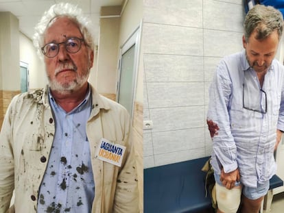 Héctor Abad Faciolince  y Sergio Jaramillo reciben atención medica tras el atentado.