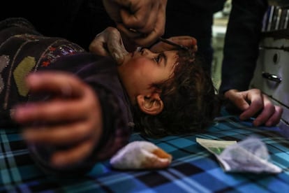 Un niño herido en un bombardeo es atendido en el hospital de Duma, Guta Oriental, en las afueras de Damasco (Siria), el pasado 3 de marzo.