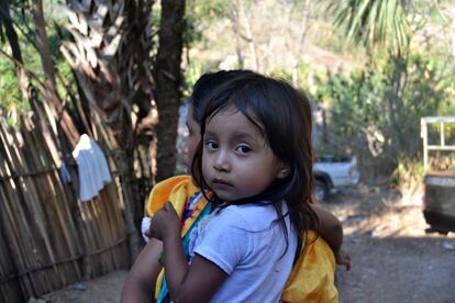 Un 67% de los niños menores de cinco años del municipio de Jocotán padecen de desnutrición crónica, muy por encima de la media nacional. Pero a pesar de la gravedad de la situación, el presupuesto del Ministerio de Salud para combatir la desnutrición se ha reducido de 137,5 millones de euros en 2015 a 87 millones este año.