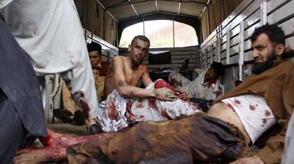 Heridos en el atentado de Peshawar espera ser evacuados en una camioneta .