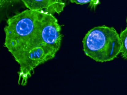 Glóbulos blancos infectados por la bacteria de la peste bubónica.