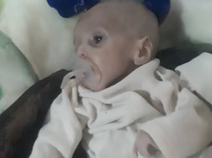 Ozair, un bebé de cuatro meses, ingresado en el Hospital de Ataturk.