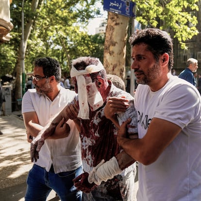 An injured man is helped to leave the scene after an explosion in downtown Tehran, amid Israel's two-day campaign of strikes against Iran, Sunday, June 15, 2025. (AP Photo/Amir Kholousi/ISNA)