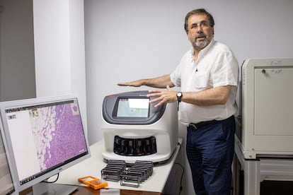 Marcial García, patólogo del Hospital Puerta del Mar de Cádiz, junto a una pantalla con células cancerosas.