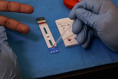 Una prueba para detectar el VIH en México, en 2024.