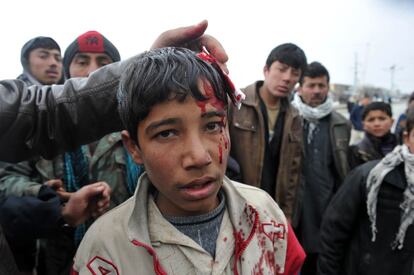 Un niño afgano herido a las puertas de la base. "Nosotros los afganos no queremos a estos cristianos e infieles, son el enemigo de nuestras tierras, nuestro honor y nuestro Corán", ha declarado Haji Shirin, uno de los que protestaba.
