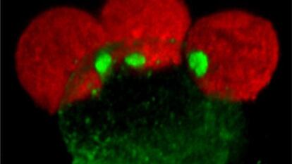 Virus de la inmunodeficiencia infectando una célula.