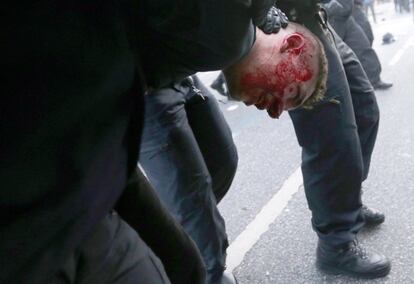 Un manifestante con sangre en la cabeza es reducido por la policía durante la protesta.