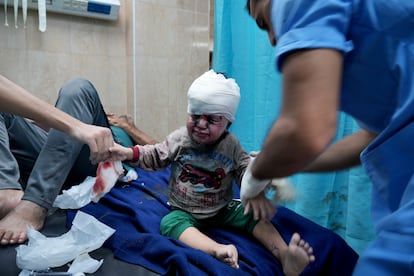 Un niño palestino herido en un bombardeo israelí recibía tratamiento en un hospital de Deir al Balah, en el sur de la franja de Gaza, este viernes.