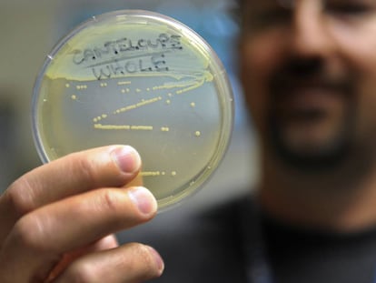 An employee at the Colorado public health department holds up a listeria sample.