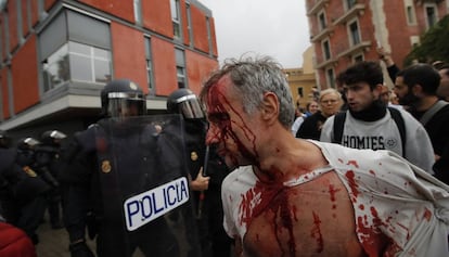 Un hombre herido en la escuela Mediterrània de Barcelona, durante la jornada del referéndum ilegal del 1-O.