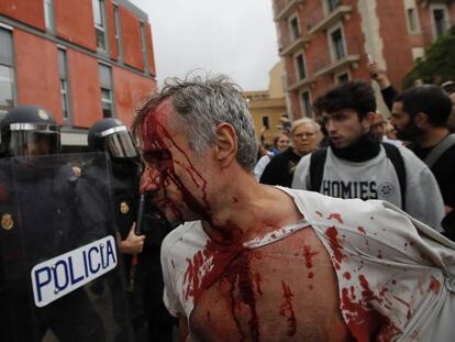 Un hombre herido en la escuela Mediterrània de Barcelona, durante la jornada del referéndum ilegal del 1-O.