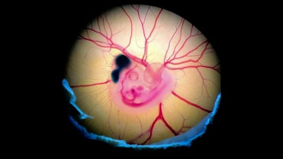 A chick embryo in the egg, after receiving the injection of the reagent that allows investigating the date of birth of neurons.