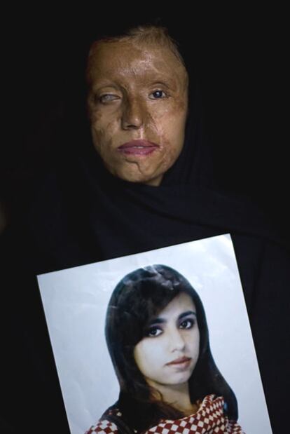 Uno de los 10 retratos de mujeres con el rostro desfigurado realizados por Emilio Morenatti para el proyecto <i>Violencia de género en Pakistán </i>(2008), primer premio Fotopres.