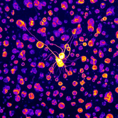 Formation of solid aggregates of CPEB4 in experiments with purified proteins.