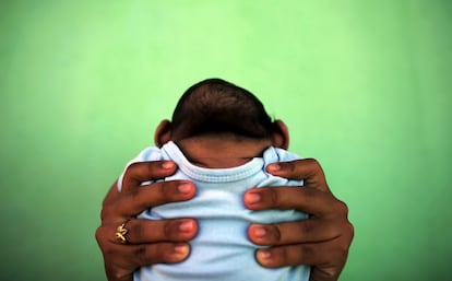 Una mare sosté el seu fill de 4 mesos nascut amb microcefàlia pel virus del zika, davant de casa seva, a Olinda (Brasil), l'11 de febrer del 2016.
