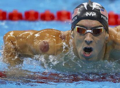 Moratones en el cuerpo de Michael Phelps, resultado del 'cupping' o ventosaterapia.